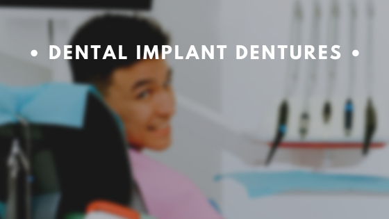 Dental Implant Dentures fjkhj